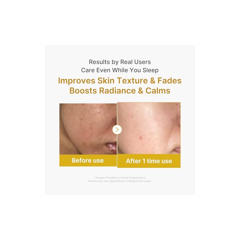 Kojic Acid Turmeric Night Wrapping Mask by Medicube for Women
