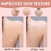 Exfoliating Gloves, Bath SPA Exfoliating Mitts Body Scrubber for Removing