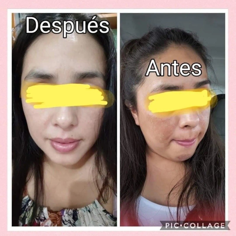 Crema Aclaradora Quita Manchas Paño Y Sol Melasma Todo Tipo