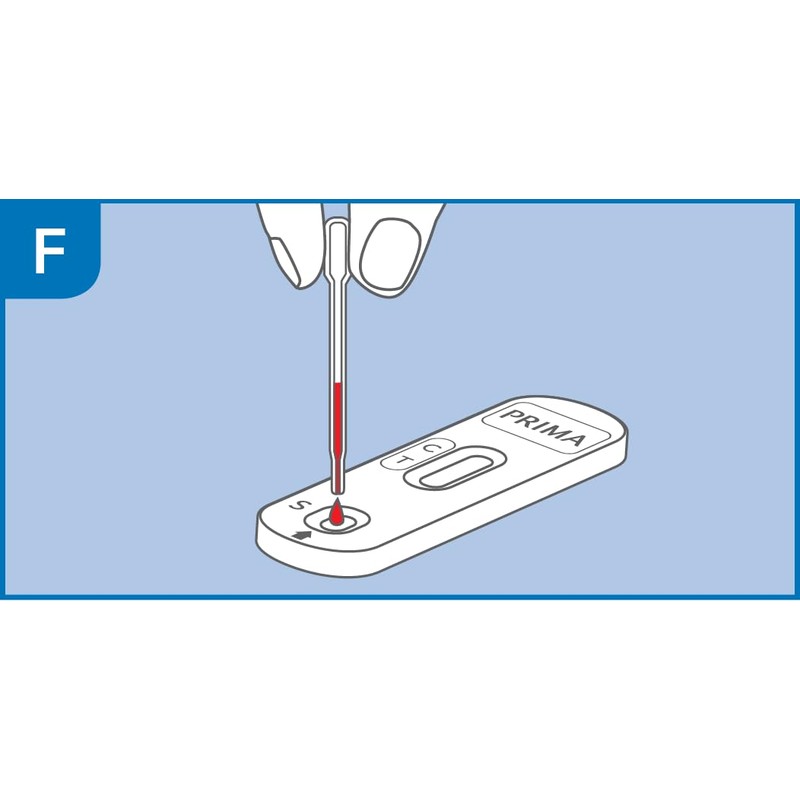 PRIMA Prostate Home PSA Test