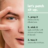 e.l.f. SKIN Blemish Breakthrough Pimple Patches - 36 Count
