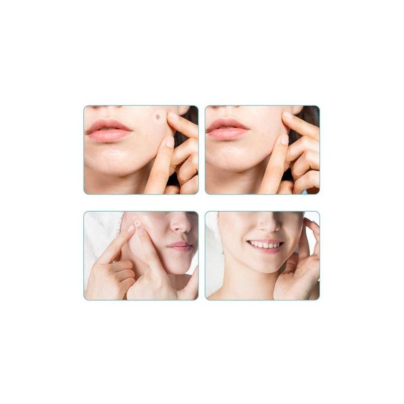 スポットパッチ CICAパッチ 敏感肌 肌荒れスキンケア 毛穴ケア シ アクネパッチ大容量 昼用+夜用 スキンケア部分パック ニキピパッチ