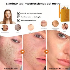 1 Pcs Jabón Turmeric Soap, Jabón de Cúrcuma y Ácido Kójico,Hidratación Profunda, Iluminador de Piel, Reduce Manchas Oscuras y Acné, Suave para Piel Se
