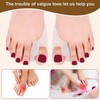 Bunion Cushion Protector and Big Toe Separator FOYOLO 8 Pack