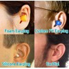 EarDial HiFi Earplugs - Invisible Hearing Protection for Concerts, Music