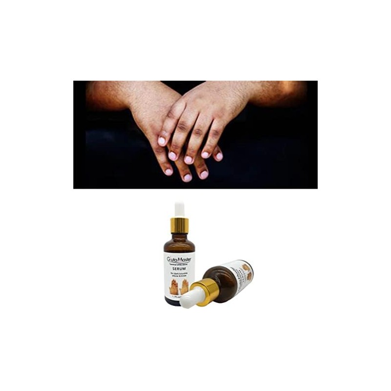 Get Rid of Dark Knuckles In 7 Days Serum Intense