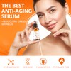 Atnadov Vitamin C Facial Serum 20%, Anti-Aging Vitamin C Serum