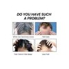 Tratamiento De Sérum Hair Fast Contra El Crecimiento Adelgaz
