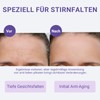 Sufchin Wrinkle Plasters, Pack of 20 Face Lifting Tape Against