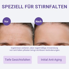 Sufchin Wrinkle Plasters, Pack of 20 Face Lifting Tape Against Anger Forehead Wrinkles Overnight Sweatproof & Skin-Friendly, Anti Wrinkle Plasters with Positive Patch Effect, Face Care for Sensitive Skin