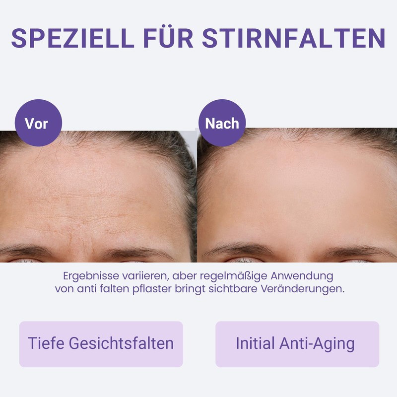 Sufchin Wrinkle Plasters, Pack of 20 Face Lifting Tape Against