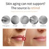 Eelhoe Eternity Vitamin C Serum Dark Spot Corrector, Esencia de
