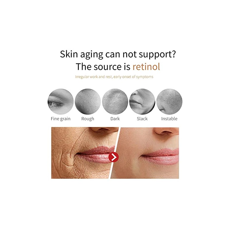Eelhoe Eternity Vitamin C Serum Dark Spot Corrector, Esencia de