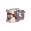 FUREIN SMILE Dental Typodont Teeth Model - Practice Dentist Tooth