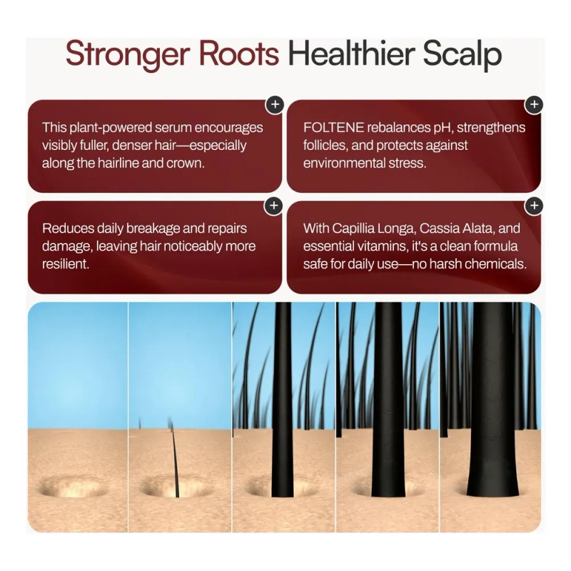 Serum Para El Crecimiento Del Cabello Foltene Tratamiento Pa