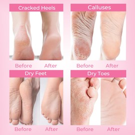 SAISZE Foot Peel Mask, Lavender, 4 Pairs