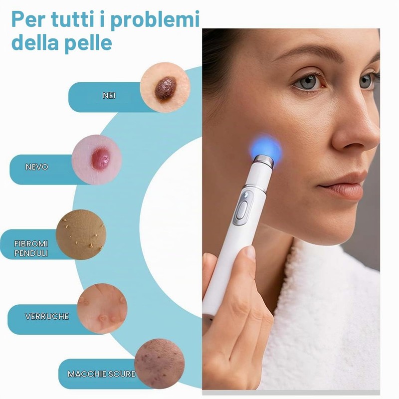 Tomedeks 1 Pezzo Penna per Acne a luce Blu, Penna