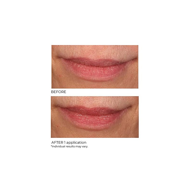 NASSIF MD Exfoliante Labial Nassifmd De Vainilla Y Azúcar, Hidratante
