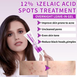 12% Acid Serum Facial Cream,Face Spot Treatment Serum Cream,Acne Treatment Creams for Reduces Acne & Soothes Redness,Skin Care Pimple Creams with Salicylic Acid&Niacinamide,Suitable for All Skin Types