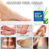 Cracked Heel Repair Cream - Heel Balm Stick 40g -