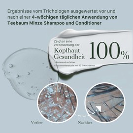 Good&All Conditioner für Trockene, Juckende Kopfhaut mit Teebaumöl, Pfefferminze - Sulfatfrei, Silikonfrei, Parabenfrei - Anti-Frizz - 400ml