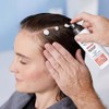 Nioxin Sistema #4 Tratamiento Intensivo para Cuero Cabelludo Anticaída 100