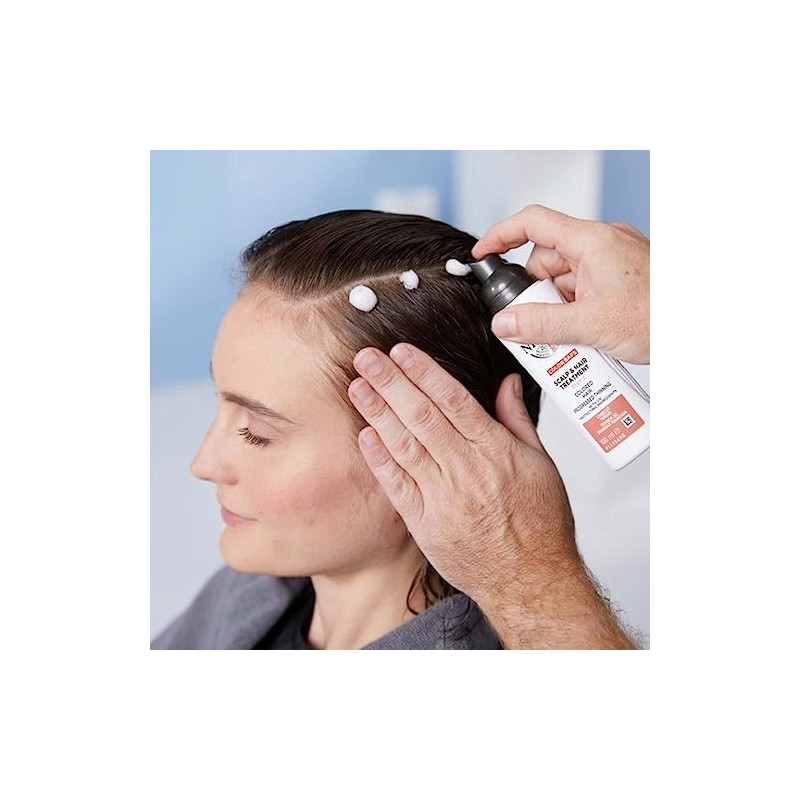 Nioxin Sistema #4 Tratamiento Intensivo para Cuero Cabelludo Anticaída 100