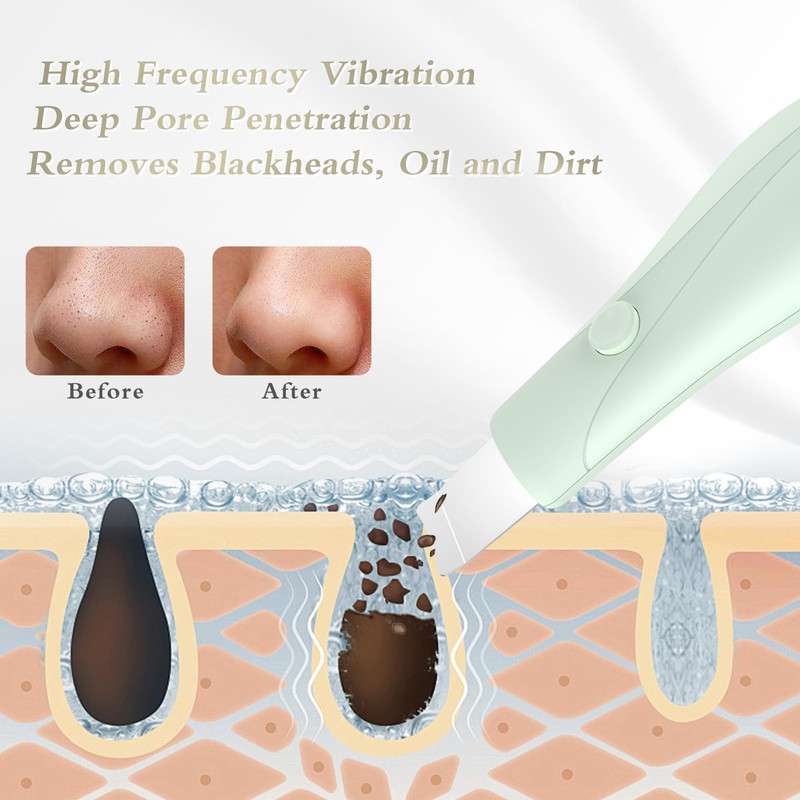 Dual-Mode Blackhead Remover Tools- Skin Scrubber Face Spatula | Battery/Handheld