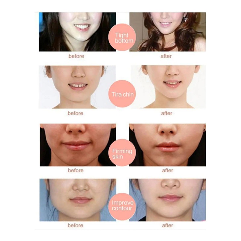Mascarilla De Colágeno Para Estiramiento Facial,