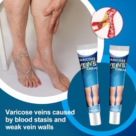 Wonsters Varicose Veins Cream, Vein Ointment Cream Against Varicose Veins, Varicose Veins Cream, Varicose Veins Relief Cream, Vein Ointment Cream Against Varicose Veins