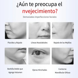 Dispositivo De Belleza Con Faja Mentonera, Tecnología Ems, Luz Roja Y Nanopore Para Tratamiento Facial, Reducción De Papada Y Grasa