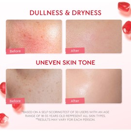 crema facial hidratante e iluminadora con 5% Niacinamide, gel cream con granada para tono desigual y Allantoin para piel sensible, 100 g