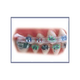 Morgan Bumper Braces Cover Lip Protector Qty 2 - Clear