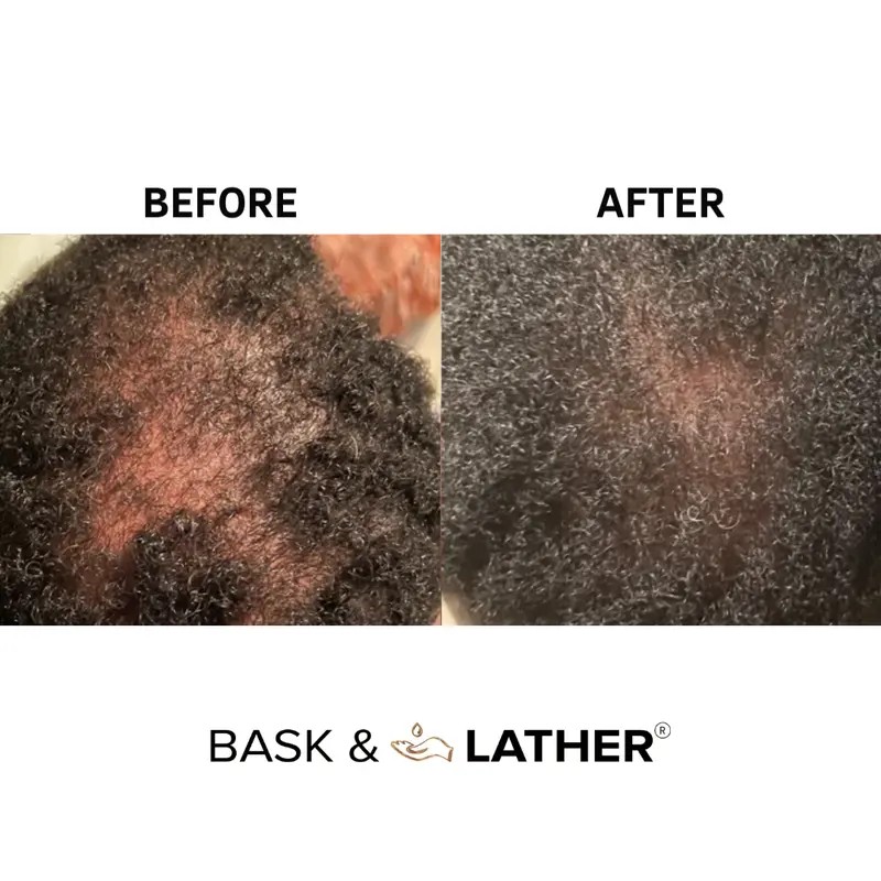 Stimulating Scalp & Hair Balm with Shea Butter and Mango