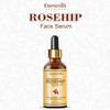Generic Rosehip oil for face Glowing & Brightening, anti-ageing rosehip