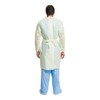 Halyard Basics Disposable SMS Protective Procedure Gown Yellow X-Large 10
