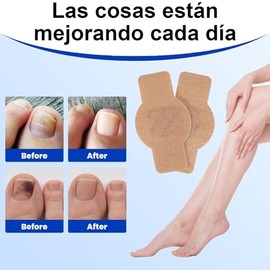 42 Pieces Parches De Cuidado Para Las UñAs,Parche Corrector De UñAs De Los Pies,Treatment Nail Support Nail Care,Reparadores Intensos - Mejora el Colo