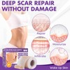 Silicone Scar Sheets, Silicone Scar Tape, Reusable Professional Scar Silicone