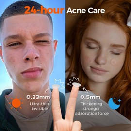 TKTK Bulk Pimple Patches for Face, 435 Patches 4 Size Acne Patches Day and Night, Hydrocolloid Patch Thin & Thick Pimple Stickers for Covering Zits, Blemishes and Breakouts