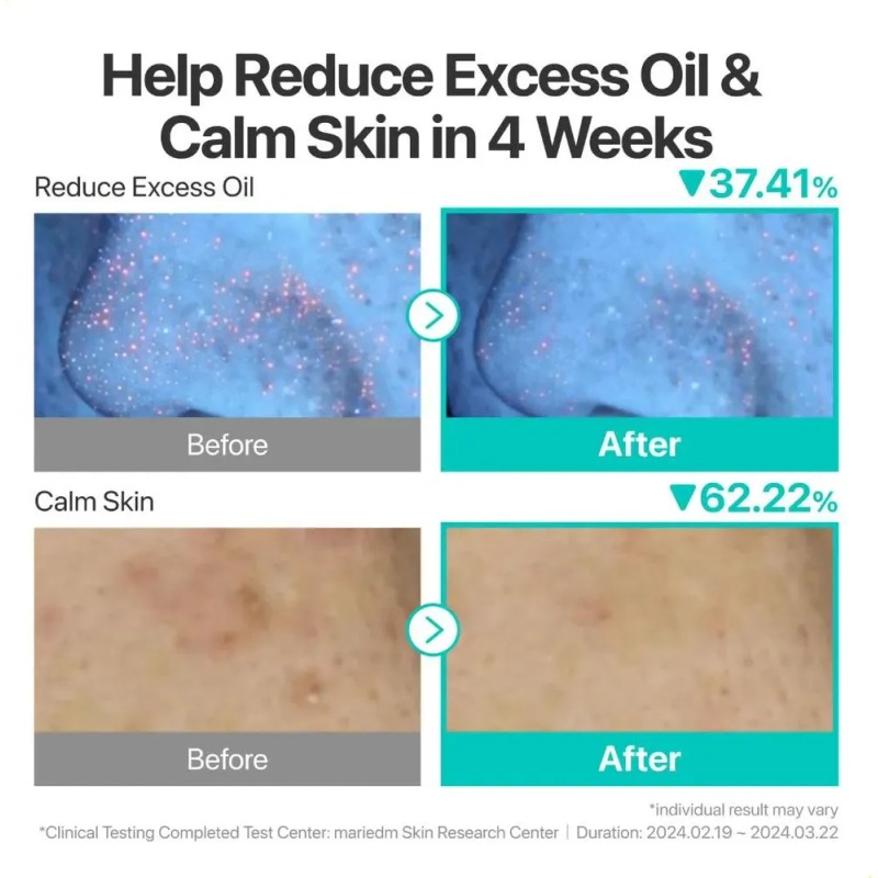 Sérum Calmante E Hidratante Activo Con Pantenol (b5) 50