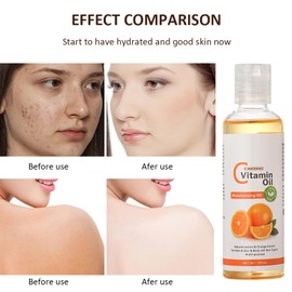 Vitamin C Body Massage Oil,Vitamin C Oil,Vitamin C Serum Face Serum,Natural Skin Care for Hydrate,Vitamin C Serum for Face Skincare Serum,Natural Massage Oils for Massage Therapy