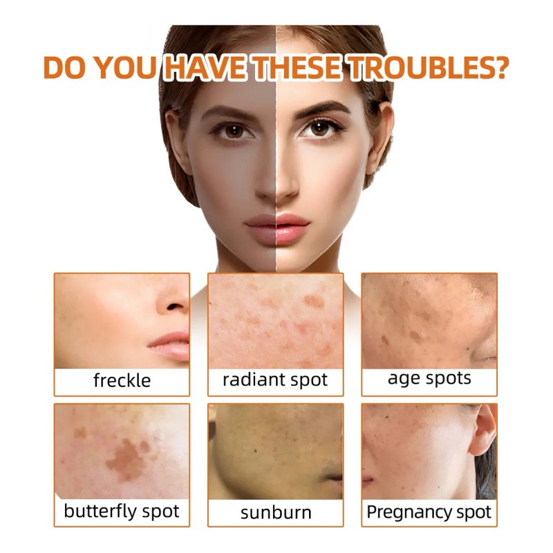 Jabón Limpiador Para Exfoliación Natural Y Aclarado De Manch
