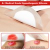FRESINIDER 7"x7" (Pack of 10) Wound Silicone Sacral Foam Dressing