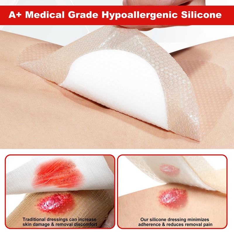 FRESINIDER 7"x7" (Pack of 10) Wound Silicone Sacral Foam Dressing