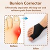 1 Pair Bunion Corrector Big Toe Straightener with Heel Strap