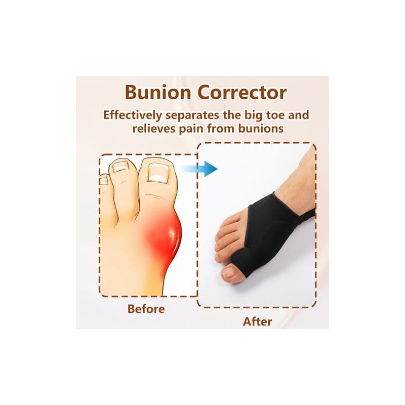 1 Pair Bunion Corrector Big Toe Straightener with Heel Strap