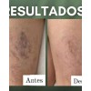 Gel De Castaña De Indias Para Varices Farmasi Dr. C