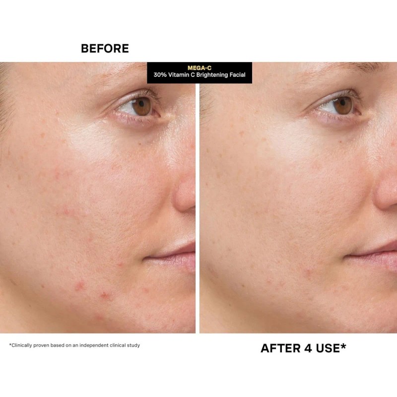 Kate Somerville Mega-c 30% Vitamina C Máscara Iluminadora