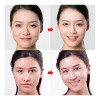 Parche De Estiramiento Facial En Forma De V Transpirable F