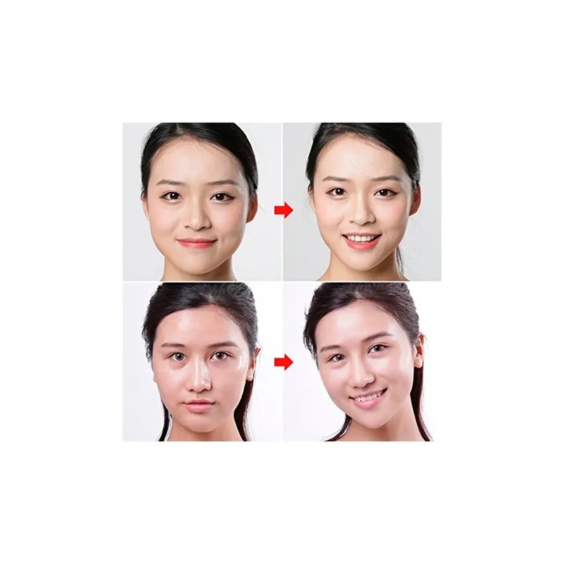 Parche De Estiramiento Facial En Forma De V Transpirable F
